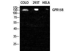Western Blotting (WB) image for anti-G Protein-Coupled Receptor 158 (GPR158) (N-Term) antibody (ABIN3175351) (GPR158 抗体  (N-Term))