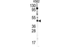 Western Blotting (WB) image for anti-Protein Arginine Methyltransferase 8 (PRMT8) antibody (ABIN2996585) (PRMT8 抗体)