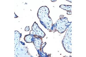 Immunohistochemistry of paraffin-embedded human placenta using MUC1 Rabbit pAb (ABIN6131522, ABIN6144194, ABIN6144195 and ABIN6213810) at dilution of 1:100 (40x lens). (MUC1 抗体  (AA 1182-1255))