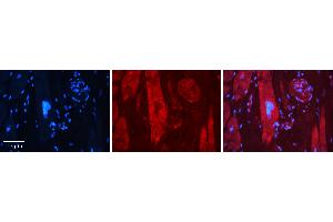 Rabbit Anti-MAP1LC3A Antibody   Formalin Fixed Paraffin Embedded Tissue: Human heart Tissue Observed Staining: Cytoplasmic Primary Antibody Concentration: 1:100 Other Working Concentrations: N/A Secondary Antibody: Donkey anti-Rabbit-Cy3 Secondary Antibody Concentration: 1:200 Magnification: 20X Exposure Time: 0. (MAP1LC3A 抗体  (N-Term))