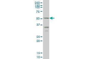 ENTPD5 monoclonal antibody (M07), clone 4A5 Western Blot analysis of ENTPD5 expression in HepG2 . (ENTPD5 抗体  (AA 319-400))