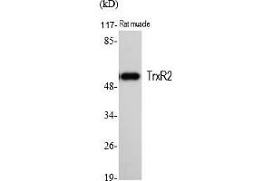 Western Blot analysis of various cells using TrxR2 Polyclonal Antibody. (TXNRD2 抗体  (AA 440-520))