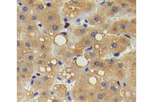 Used in DAB staining on fromalin fixed paraffin-embedded liver tissue (IL17 Receptor B 抗体  (AA 61-200))