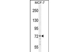 MED25 Antibody (N-term) ( (ABIN654162 and ABIN2844026) western blot analysis in MCF-7 cell line lysates (35 μg/lane). (MED25 抗体  (AA 112-140))