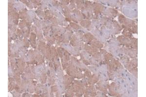 Immunohistochemistry (IHC) image for anti-Serpin Family C Member 1 (SERPINC1) (AA 33-465) antibody (ABIN7444769)
