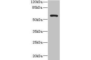 Western blot All lanes: ZCCHC4 antibody at 0.