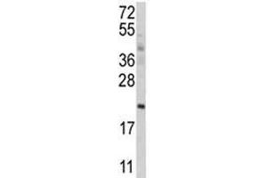 Western blot analysis of ATG12 antibody and MCF-7 lysate. (ATG12 抗体  (AA 1-50))