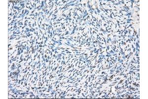 Immunohistochemical staining of paraffin-embedded colon tissue using anti-PPP5Cmouse monoclonal antibody. (PP5 抗体)