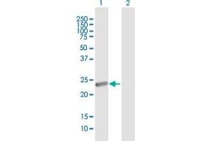 Western Blot analysis of METT5D1 expression in transfected 293T cell line by METT5D1 MaxPab polyclonal antibody.