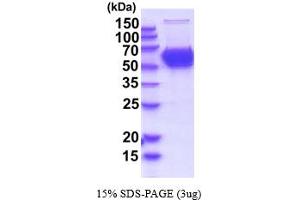SDS-PAGE (SDS) image for Carnosine Dipeptidase 1 (Metallopeptidase M20 Family) (CNDP1) (AA 27-507) (Active) protein (His tag) (ABIN7529351) (CNDP1 Protein (AA 27-507) (His tag))