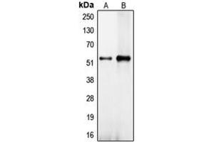 Western blot analysis of CEP57 expression in NT2D1 (A), HeLa (B) whole cell lysates. (CEP57 抗体  (Center))