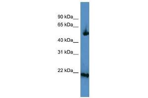 Western Blotting (WB) image for anti-Optic Atrophy 3 (Autosomal Recessive, with Chorea and Spastic Paraplegia) (OPA3) (C-Term) antibody (ABIN929355)