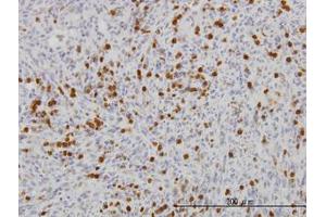 Image no. 2 for anti-Gardner-Rasheed Feline Sarcoma Viral (V-Fgr) Oncogene Homolog (FGR) (AA 1-90) antibody (ABIN598685) (Fgr 抗体  (AA 1-90))