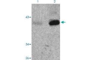 Western blot analysis of Lane 1: 293 cells, Lane 2: TNF treated 293 cells with Nfkbie (phospho S22) polyclonal antibody  at 1:500-1:1000 dilution. (NFKBIE 抗体  (pSer22))