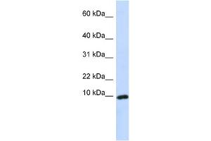 WB Suggested Anti-CXCL9 Antibody Titration:  0. (CXCL9 抗体  (Middle Region))