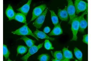 IF analysis of PI 3 Kinase p85 alpha/PIK3R1 using anti-PI 3 Kinase p85 alpha/PIK3R1 antibody (ABIN7599781).