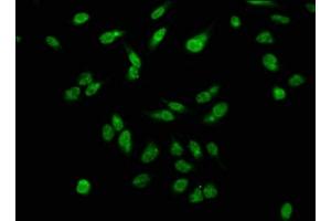 Immunofluorescence staining of Hela cells with ABIN7139615 at 1:2. (H2AFX 抗体  (pSer139))