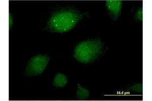 Immunofluorescence of monoclonal antibody to ING2 on HeLa cell. (ING2 抗体  (AA 1-280))