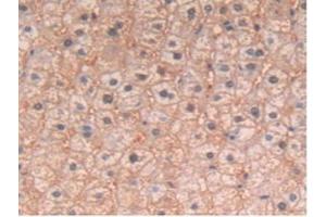 Detection of IL4 in Human Liver Tissue using Polyclonal Antibody to Interleukin 4 (IL4) (IL-4 抗体  (AA 25-153))