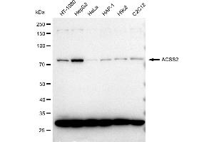 Western blotting analysis using ACSS2 antibody (ABIN7797499). (Recombinant ACSS2 抗体)