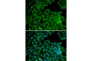Immunofluorescence analysis of U20S cell using CDK7 antibody. (CDK7 抗体  (AA 1-346))