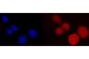 IF analysis of PCBP2/hnRNP E2 using anti-PCBP2/hnRNP E2 antibody (ABIN7600448). (PCBP2 抗体  (AA 197-276))