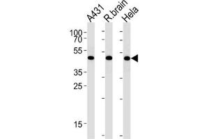 Western Blotting (WB) image for anti-DEAD (Asp-Glu-Ala-Asp) Box Polypeptide 39 (DDX39) antibody (ABIN3003892) (BAT1 抗体)