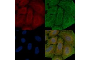 ABIN6259023 and ABIN6273879 staining Hela cells(30 min of UV treatment) by IF/ICC. (LGR4 抗体  (C-Term))