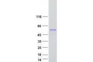 Western Blotting (WB) image for Unc-51-Like Kinase 3 (ULK3) protein (Myc-DYKDDDDK Tag) (ABIN2735009)