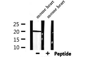 Western blot analysis of extracts from mouse heart, using ARF1 Antibody. (ARF1 抗体  (Internal Region))