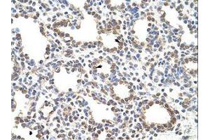 Image no. 1 for anti-Zinc Finger Protein 195 (ZNF195) (N-Term) antibody (ABIN6736198) (ZNF195 抗体  (N-Term))