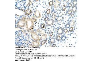 Rabbit Anti-MGC27016 Antibody  Paraffin Embedded Tissue: Human Kidney Cellular Data: Epithelial cells of renal tubule Antibody Concentration: 4. (MGC27016 (N-Term) 抗体)