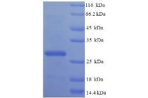 MRPL20 Protein (AA 46-149) (His-SUMO Tag)