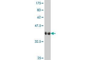 Western Blot detection against Immunogen (37. (VIPR2 抗体  (AA 24-126))