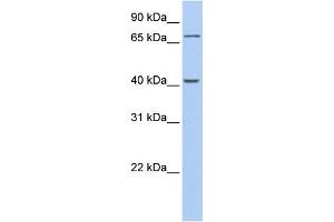 WB Suggested Anti-GALNT4 Antibody Titration:  0. (GALNT4 抗体  (C-Term))