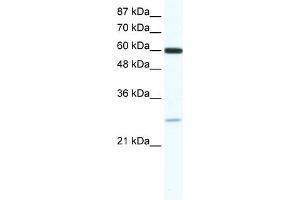 WB Suggested Anti-ZFP91 Antibody   Titration: 0. (ZFP91 抗体  (N-Term))