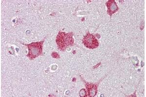 Anti-HEXA antibody IHC staining of human brain, cortex. (Hexosaminidase A 抗体  (AA 431-480))