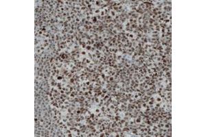 Immunohistochemical staining (Formalin-fixed paraffin-embedded sections) of human tonsil with REST monoclonal antibody, clone CL0381  shows strong nuclear immunoreactivity in the lymphoid cells. (REST 抗体)