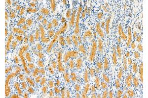 ABIN6263023 and ABIN6277536 at 1/100 staining Rat kidney tissue by IHC-P. (LTBR 抗体  (N-Term))