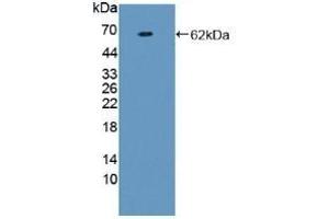 Detection of Recombinant F1+2, Human using Polyclonal Antibody to Prothrombin Fragment 1+2 (F1+2) (Prothrombin Fragment 1+2 抗体)