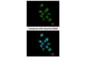 ICC/IF Image Immunofluorescence analysis of paraformaldehyde-fixed A431, using PUF60, antibody at 1:500 dilution. (PUF60 抗体  (C-Term))