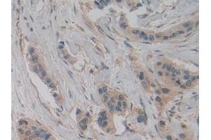 Immunohistochemistry (IHC) image for anti-Pyruvate Kinase M2 (PKM2) (AA 294-470) antibody (ABIN7438913)