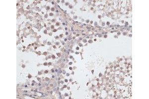 Immunohistochemistry of paraffin-embedded Rat testis using CCNE2 Polyclonal Antibody at dilution of 1:100 (40x lens). (Cyclin E2 抗体)