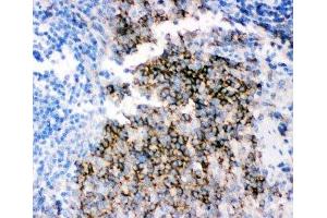 IHC-P staining of rat spleen tissue (CD79b 抗体  (AA 29-229))