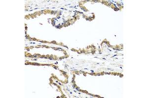 Immunohistochemistry of paraffin-embedded human prostate using OGFR antibody at dilution of 1:100 (x40 lens). (OGFR 抗体)
