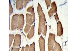 Immunohistochemistry (IHC) image for anti-Wingless-Type MMTV Integration Site Family, Member 5B (WNT5B) (AA 153-182) antibody (ABIN3029636)
