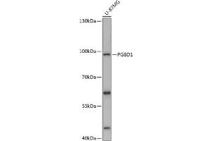 Western blot analysis of extracts of U-87MG cells, using PGBD1 antibody (ABIN7269372) at 1:1000 dilution. (PGBD1 抗体  (AA 150-450))