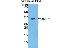 Western Blotting (WB) image for anti-ATP Binding Cassette Transporter A3 (ABCA3) (AA 1358-1635) antibody (ABIN1857856) (ABCA3 抗体  (AA 1358-1635))