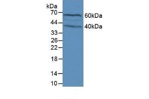 Detection of FLG in Mouse Brain Tissue using Polyclonal Antibody to Filaggrin (FLG) (Filaggrin 抗体  (AA 119-336))