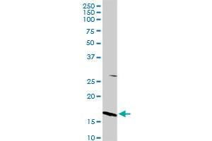 MGST1 MaxPab rabbit polyclonal antibody. (MGST1 抗体  (AA 1-155))